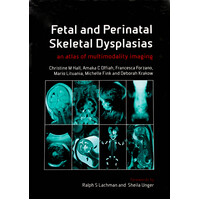 Fetal and Perinatal Skeletal Dysplasias: An Atlas of Multimodality Imaging