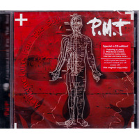 Accupuncture For The Soul -Pmt CD